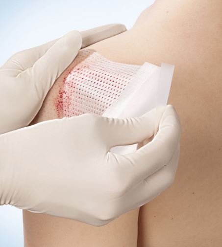 2025-09-16 01_57_37-wondzorg - Google Zoeken — Mozilla Firefox